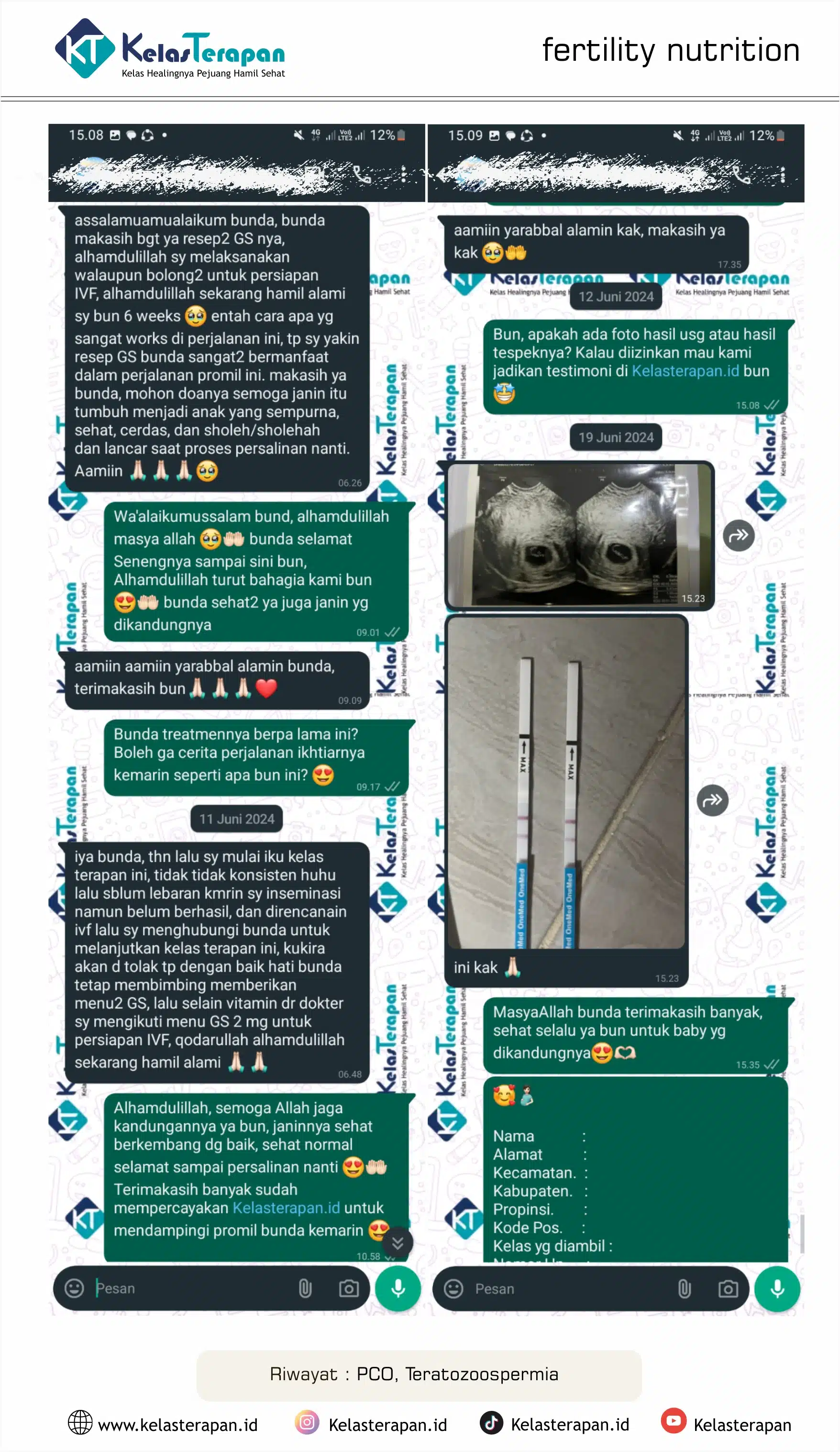 PCO + Suami Terato = Hamil Alami Berkat Nutrisi Holistik dan Treatment Tepat